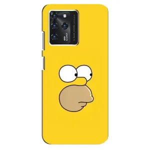 Чjхол з Сімпсонами для ZTE Blade V30 (VPrint) (Гомер)
