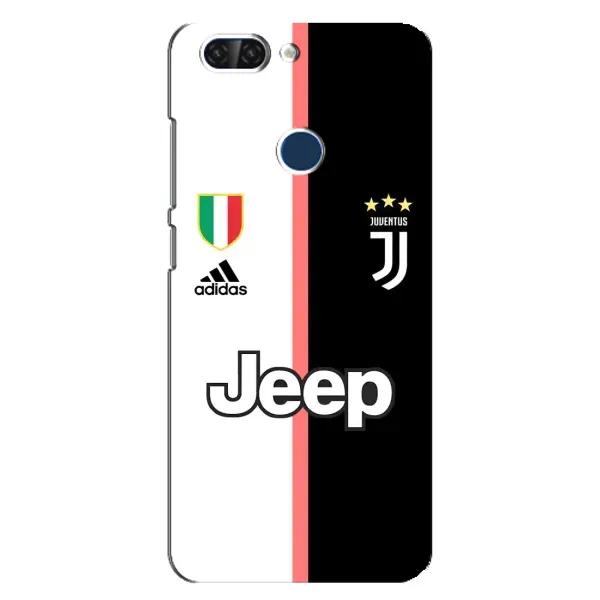 Чехол с принтом «Juventus» для ZTE Blade V9 Чехол с принтом «Juventus» для ZTE Blade V9