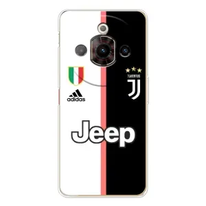 Чохли для ZTE Nubia Focus Pro (VPrint) - Футбольні клуби (Juventus)