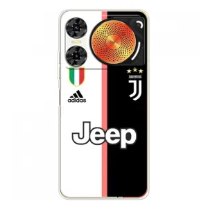 Чехлы для ZTE Nubia Music 2 (VPrint) - Футбольные клубы (Juventus)