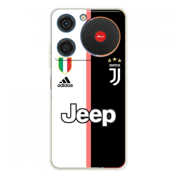 Чохол з принтом «Juventus» для ZTE Nubia Music