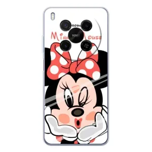 Эксклюзивный чехол для ZTE Nubia V70 Max (AlphaPrint - Мультяшные) (Маус Минни)