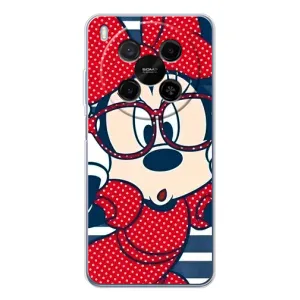 Эксклюзивный чехол для ZTE Nubia V70 Max (AlphaPrint - Мультяшные) (Маус в очках)