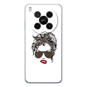 Чохли Луі Вітон для ZTE Nubia V70 Max (AlphaPrint - LOUIS VUITTON) (стильна з луі вітон)