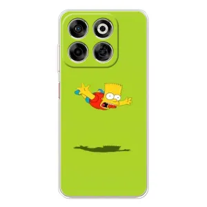 Чехол с Симпсонами для ZTE Nubia V70 (VPrint) (Барт Симпсон)
