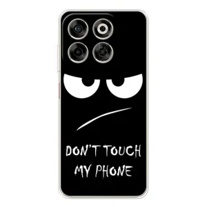 Чехол для Нубия В70 - (AlphaPrint) с печатью (ТОП продаж) (Dont Touch)