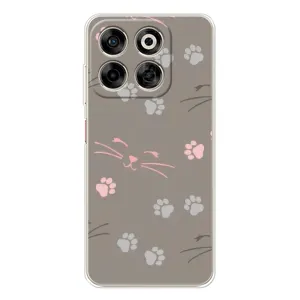 Чехол с рисунком кот на ZTE Nubia V70 (Лапы и усы)