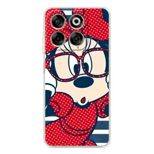 Эксклюзивный чехол для ZTE Nubia V70 (AlphaPrint - Мультяшные) (Маус в очках)