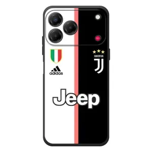 Чехлы для ZTE Nubia V80 Design (VPrint) - Футбольные клубы (Juventus)